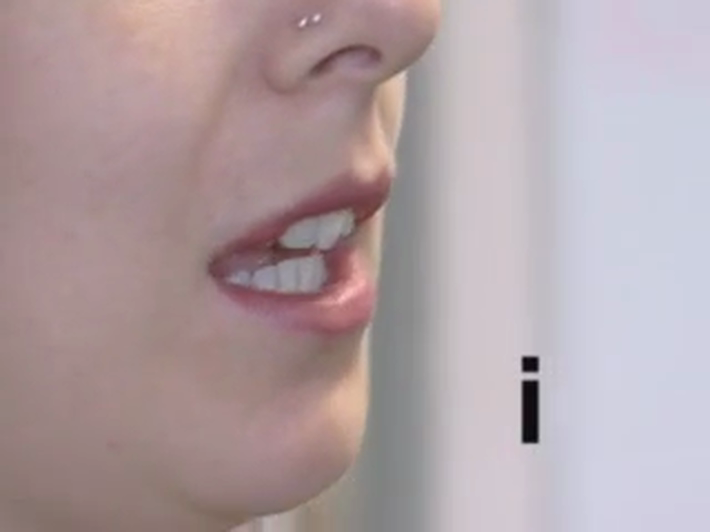 Still image for this video